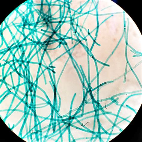 why are cyanobacteria similar to plants